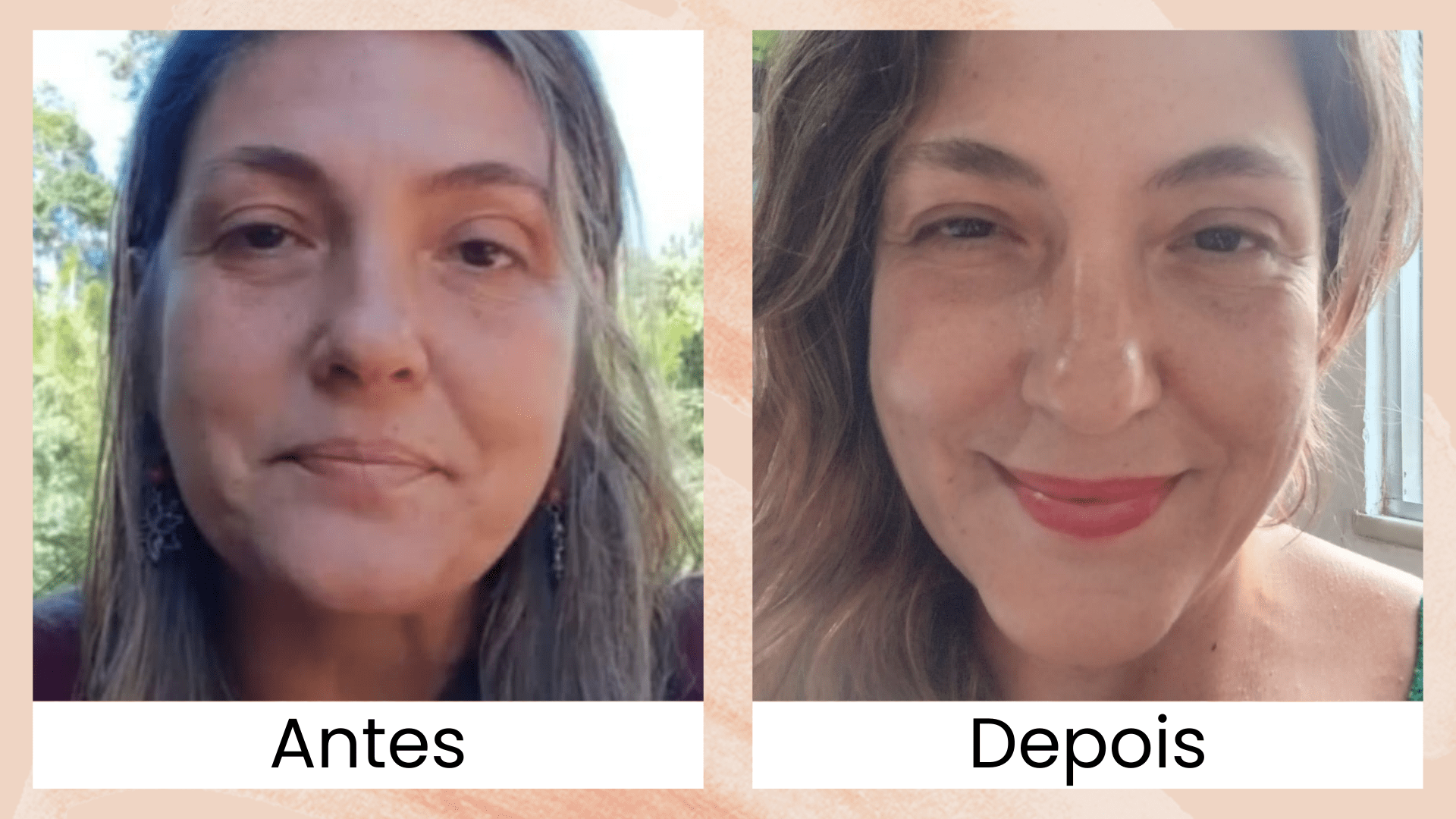 Rejuvenesça Naturalmente em Casa: Conheça o Método da Dra. Marta Rocha que Está Transformando Rostos!